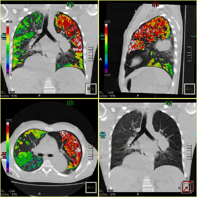 medical scans of chest